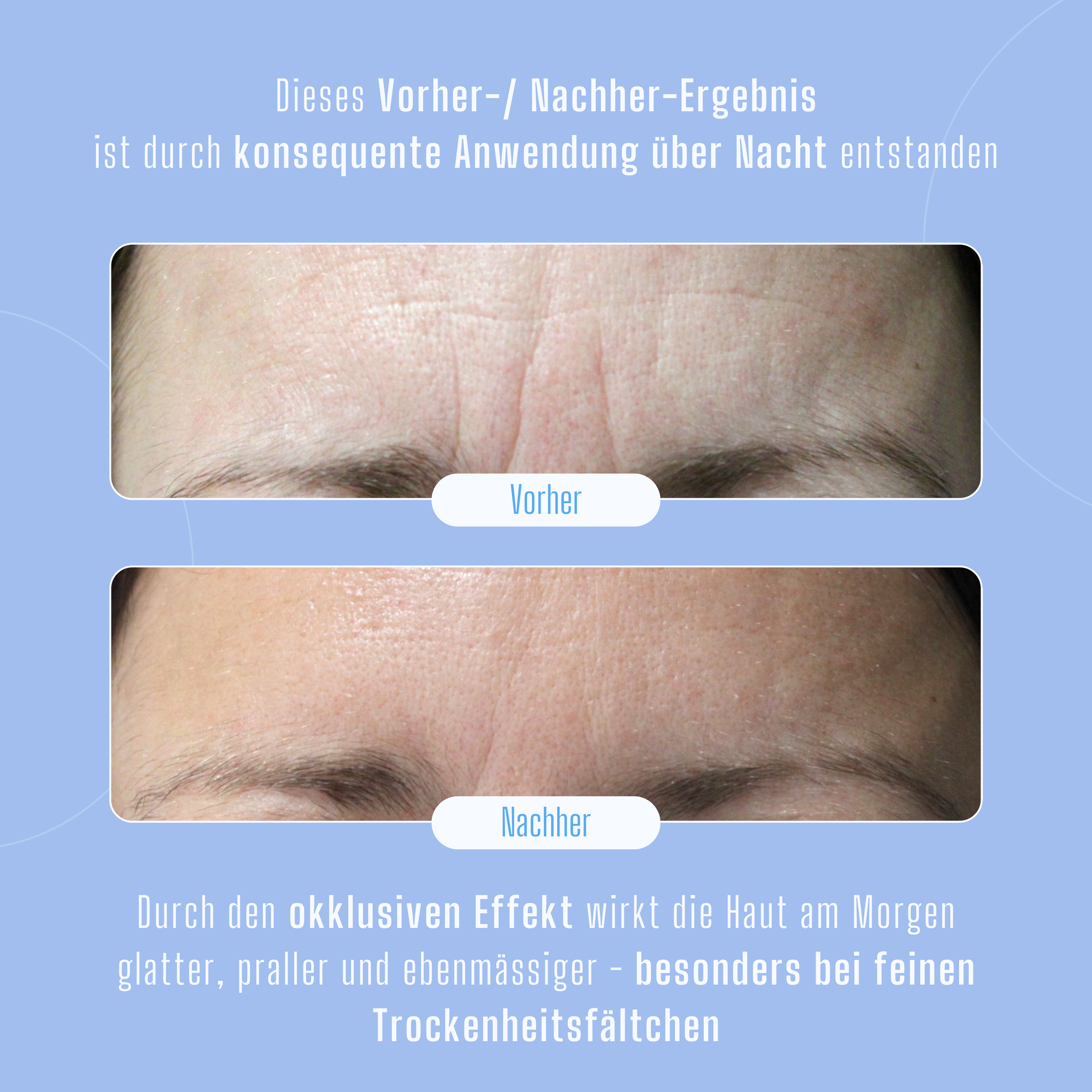 Silikonpflaster gegen Falten & Narben